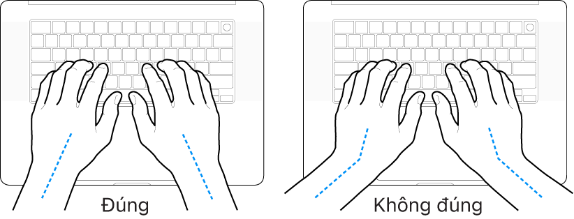 Các bàn tay đặt phía trên bàn phím, minh họa cách đặt cổ tay và bàn tay đúng và sai.