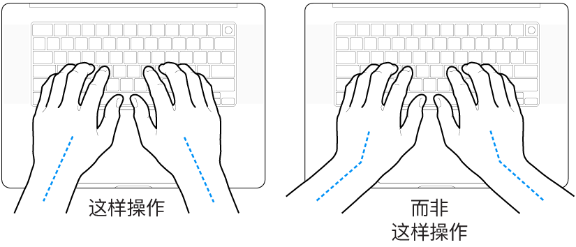 手掌放在键盘上方，显示手腕和手掌的正确对齐位置和错误对齐位置。