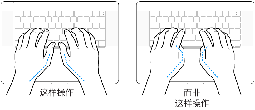 手掌放在键盘上方，显示拇指的正确放置和错误放置。