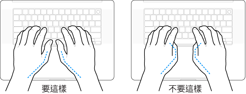 雙手置於鍵盤上,分別顯示正確與不正確的大腿姿勢。