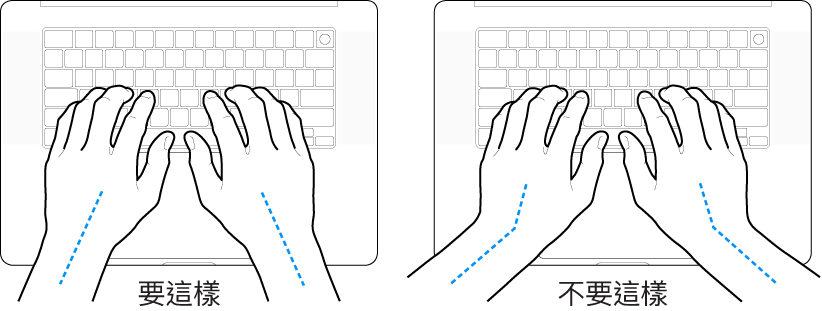 雙手置於鍵盤上,分別顯示正確與不正確的手肘與雙手對稱擺放位置。