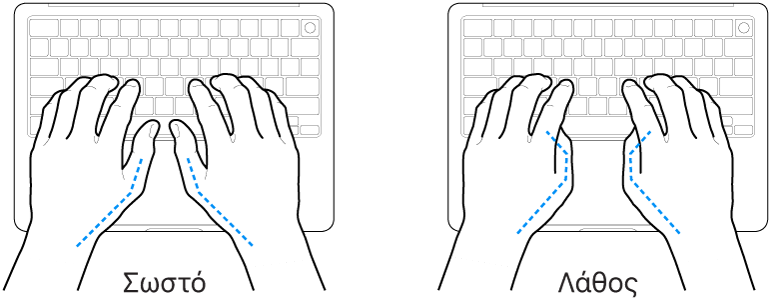 Χέρια τοποθετημένα επάνω σε ένα πληκτρολόγιο, που δείχνουν τη σωστή και τη λανθασμένη θέση των αντίχειρων.