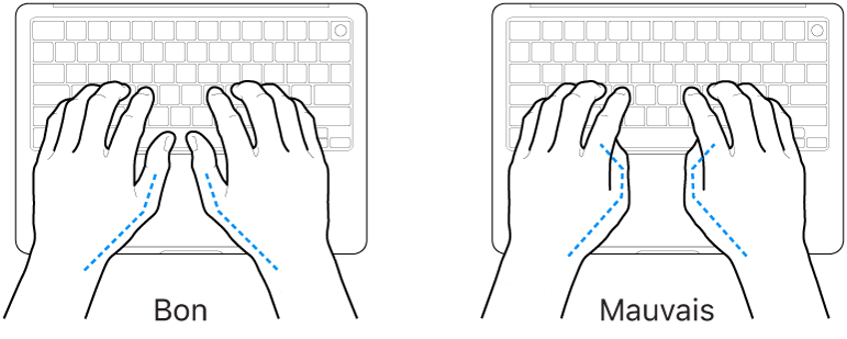 Mains placées sur un clavier, montrant la bonne et la mauvaise position des pouces.