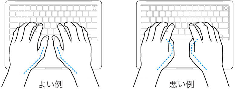 キーボードに置かれた手。親指の適切な位置と不適切な位置を示しています。