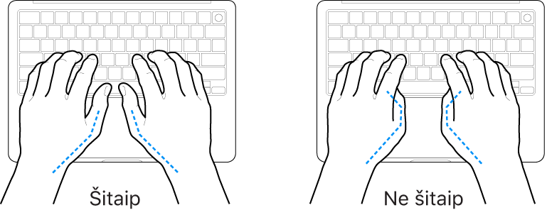 Virš klaviatūros laikomos rankos: rodoma, kaip tinkamai ir netinkamai laikyti nykščius.