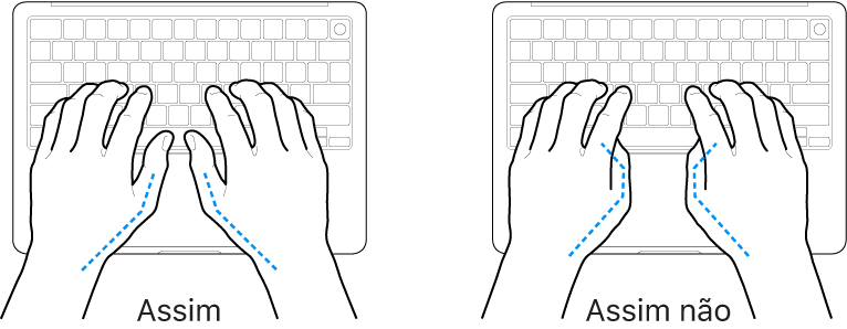 As mãos posicionadas sobre um teclado a mostrar a colocação correta e incorreta dos polegares.