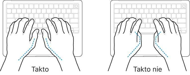 Ruky položené na klávesnici znázorňujúce správnu a nesprávnu polohu palcov.