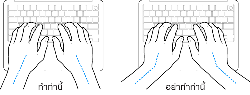 มือวางอยู่เหรือแป้นพิมพ์ แสดงตำแหน่งการวางข้อมือและแขนที่ถูกต้องและไม่ถูกต้อง