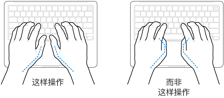 手掌放在键盘上方，显示拇指的正确放置和错误放置。