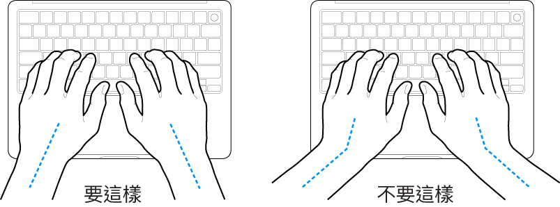 雙手置於鍵盤上,分別顯示正確與不正確的手肘與雙手對稱擺放位置。