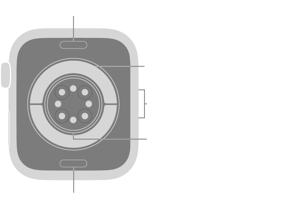 The back of Apple Watch Series 11, with the band release buttons at top and bottom, the electrical heart sensors, optical heart sensors, and blood oxygen sensors in the middle, and the speaker/air vents on the side.