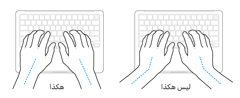 يدان موضوعتان على لوحة مفاتيح، وتظهر المحاذاة الصحيحة وغير الصحيحة للمعصم واليد.
