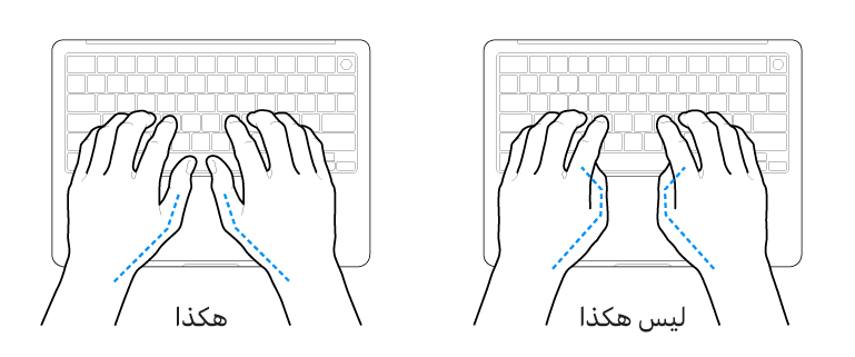 يدان موضوعتان على لوحة مفاتيح، ويظهر الوضع الصحيح وغير الصحيح للإبهامين.