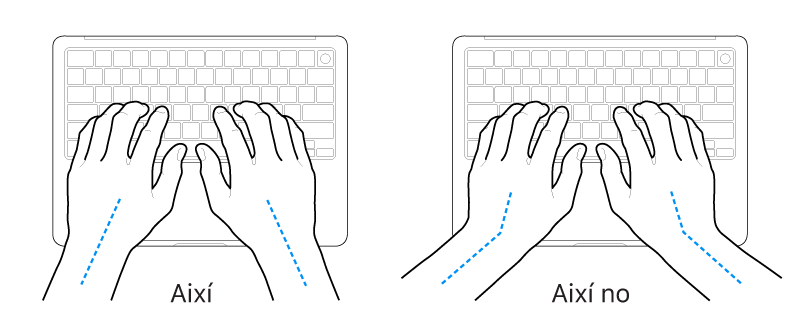 Unes mans posades sobre un teclat mostrant l’alineació correcta i incorrecta del canell i la mà.