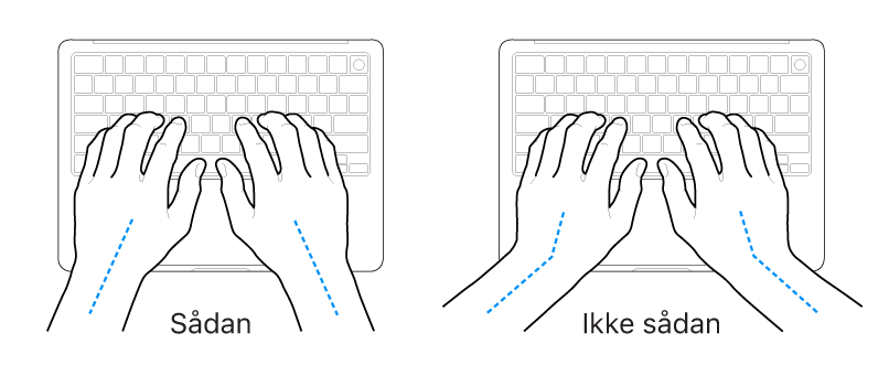 Hænder anbragt over et tastatur med rigtig og forkert position af håndled og hånd.