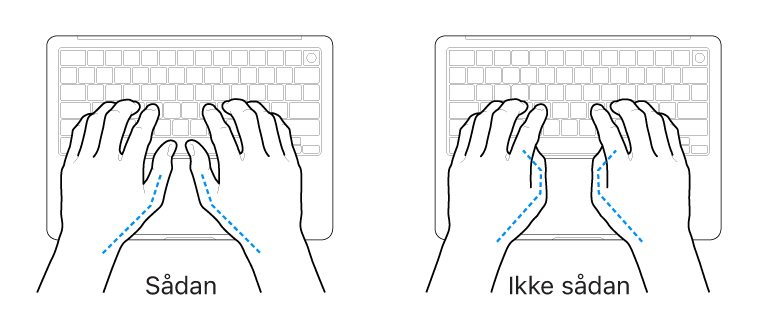 Hænder anbragt over et tastatur med rigtig og forkert position af tommelfingre.