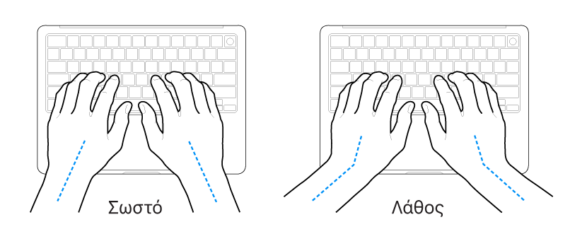 Χέρια τοποθετημένα επάνω σε ένα πληκτρολόγιο, που δείχνουν τη σωστή και τη λανθασμένη θέση των καρπών σε σχέση με τα χέρια.