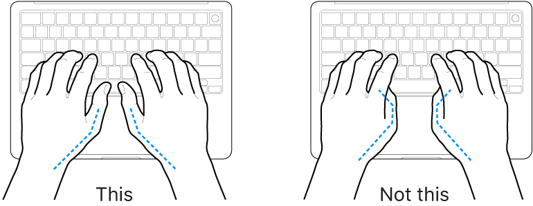 Hands positioned over a keyboard, showing correct and incorrect placement of thumbs.