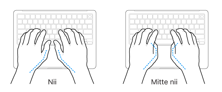 Klaviatuurile paigutatud käed, mis näitavad õiget ja valet pöidlate joondust.