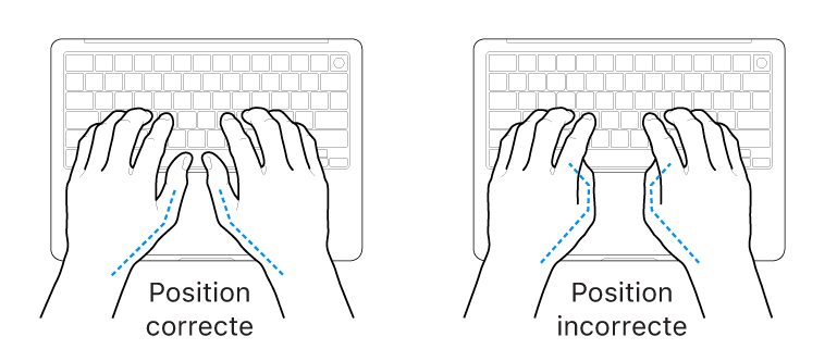 Mains placées sur un clavier, montrant la bonne et la mauvaise position des pouces.