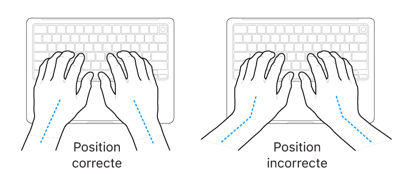 Mains placées sur un clavier, montrant le bon et le mauvais alignement des poignets et des mains.