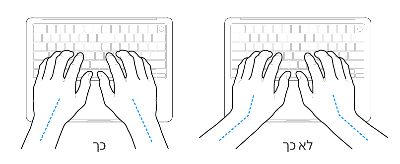 ידיים מעל מקלדת, להדגמת מנח נכון ומנח שגוי של כף היד ושורש כף היד.