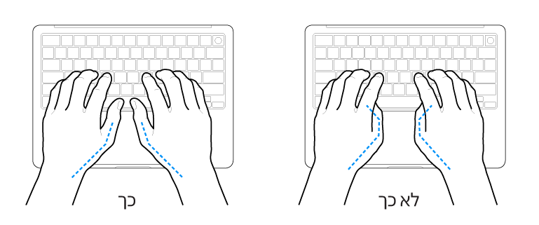 ידיים מעל מקלדת, להדגמת מנח נכון ומנח שגוי של האגודלים.