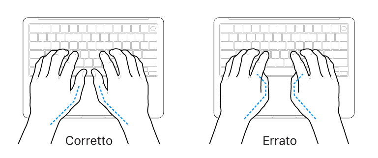 Mani posizionate su una tastiera che illustrano il posizionamento corretto ed errato dei pollici.