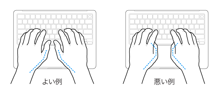 キーボードに置かれた手。親指の適切な位置と不適切な位置を示しています。