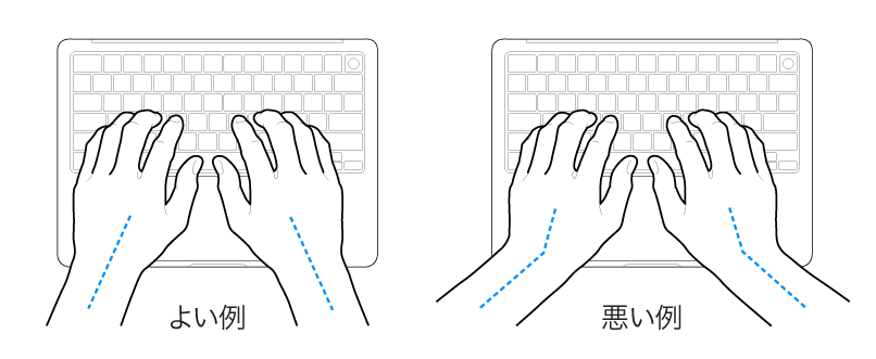 キーボードに置かれた手。手首と手の適切な位置関係と不適切な位置関係を示しています。
