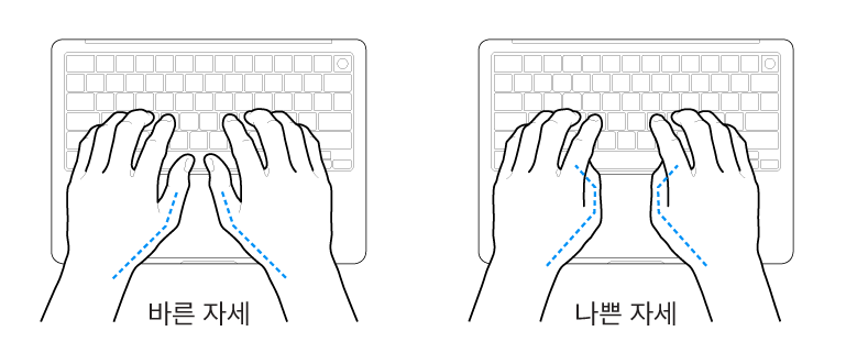 엄지손가락의 바른 위치와 잘못된 위치를 보여주는 키보드 위의 손.
