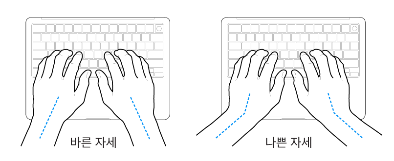 손목 및 손의 바른 자세와 잘못된 자세를 보여주는 키보드 위의 손.