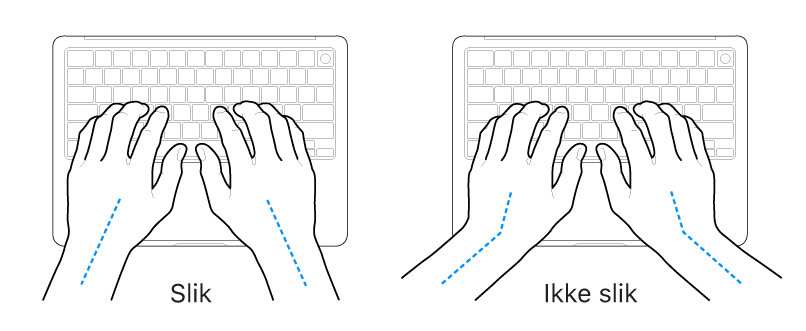 Hender plassert over et tastatur som viser riktig og feil stilling for håndledd og hender.