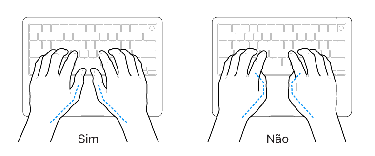 Mãos posicionadas sobre um teclado, mostrando os alinhamentos correto e incorreto dos polegares.