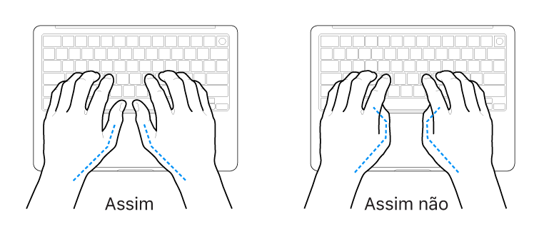 As mãos posicionadas sobre um teclado a mostrar a colocação correta e incorreta dos polegares.