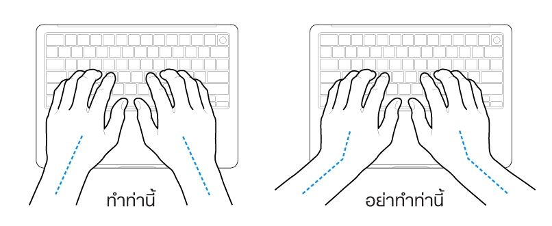 มือวางอยู่เหรือแป้นพิมพ์ แสดงตำแหน่งการวางข้อมือและแขนที่ถูกต้องและไม่ถูกต้อง