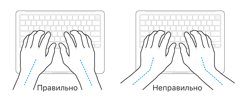 Руки розташовано над клавіатурою й показано правильне та неправильне положення кистей і рук.