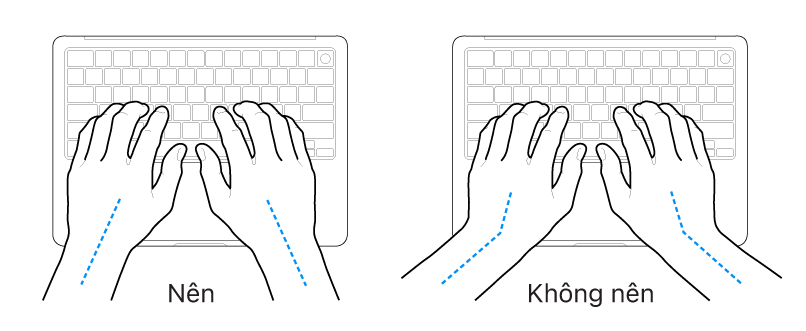 Các bàn tay đặt phía trên bàn phím, minh họa cách đặt cổ tay và bàn tay đúng và sai.
