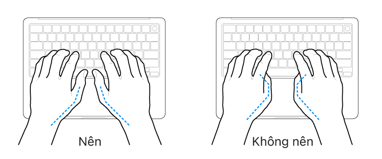 Các bàn tay đặt phía trên bàn phím, minh họa cách đặt ngón cái đúng và sai.