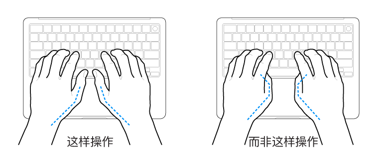 手掌放在键盘上方，显示拇指的正确放置和错误放置。