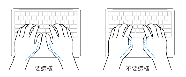 雙手置於鍵盤上，分別顯示正確與不正確的大腿姿勢。