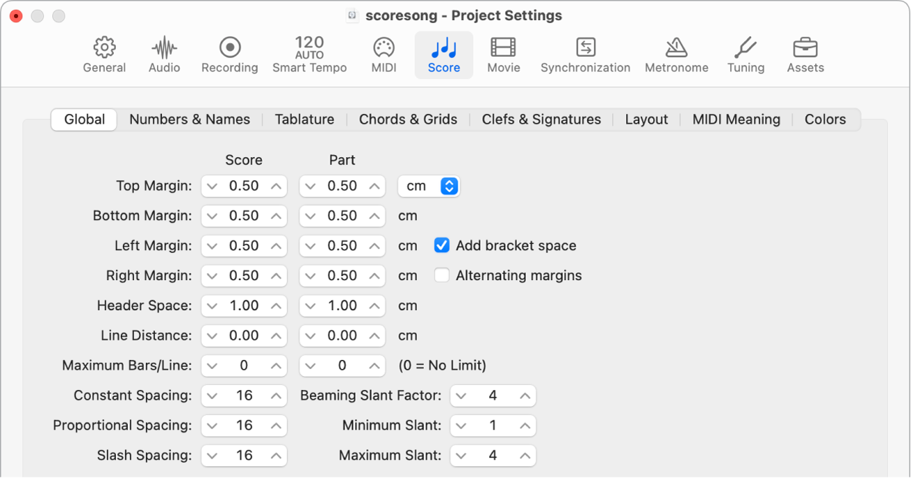 Figure. Global pane in the Score project settings.
