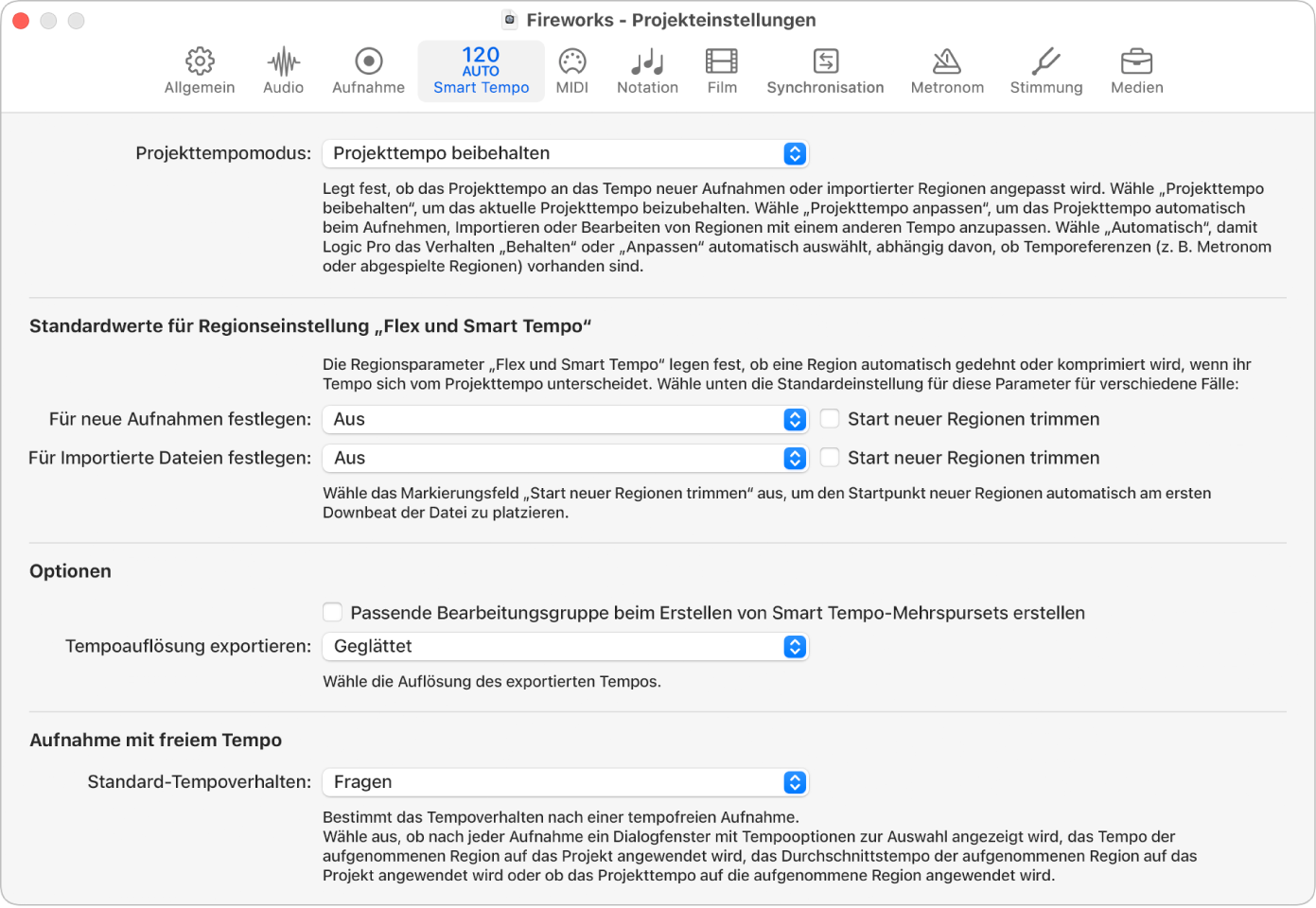 Abbildung. Projekteinstellungsbereich „Smart Tempo“