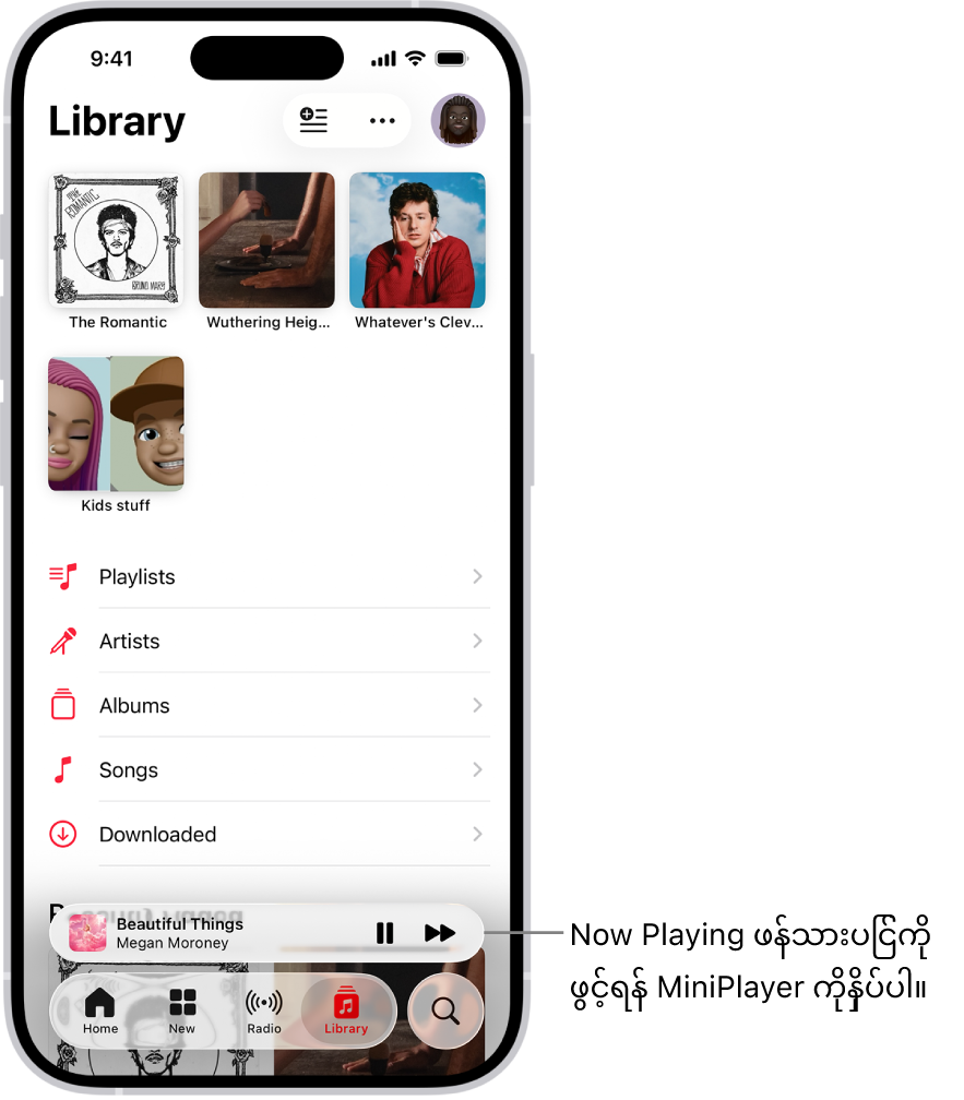 အောက်ခြေနားတွင် MiniPlayer ကိုပြသနေသော Library ဖန်သားပြင်။ လက်ရှိဖွင့်ထားသောသီချင်း၏ ခေါင်းစဥ်ကို MiniPlayer ကပြပေးသည်။ Pause နှင့် Next Track ခလုတ်များသည် သီချင်းခေါင်းစဥ်၏ ညာဘက်တွင်ရှိသည်။ Now Playing ဖန်သားပြင်ကိုဖွင့်ရန် MiniPlayer ကိုနှိပ်ပါ။