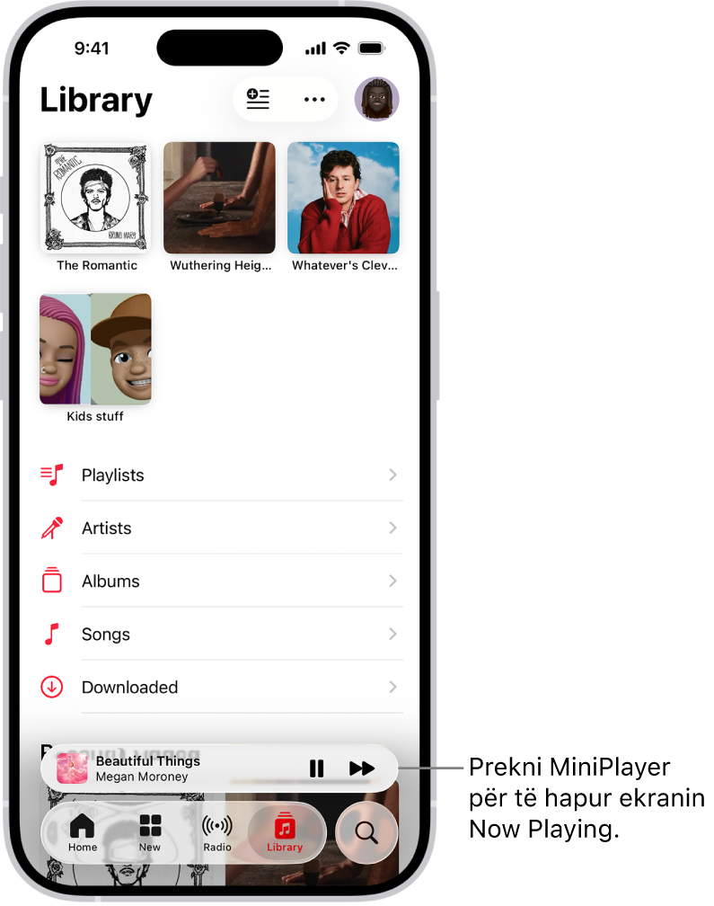 Ekrani Library, që tregon MiniPlayer afër fundit. MiniPlayer tregon titullin e këngës që po luhet. Butonat Pause dhe Track Next janë në të djathtë të titullit të këngës. Prekni MiniPlayer për të hapur ekranin Now Playing.