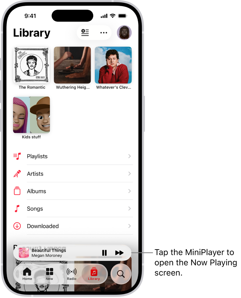 The Library screen, showing the MiniPlayer near the bottom. The MiniPlayer shows the title of the song that’s playing. The Pause and Next Track buttons are to the right of the song title. Tap the MiniPlayer to open the Now Playing screen.