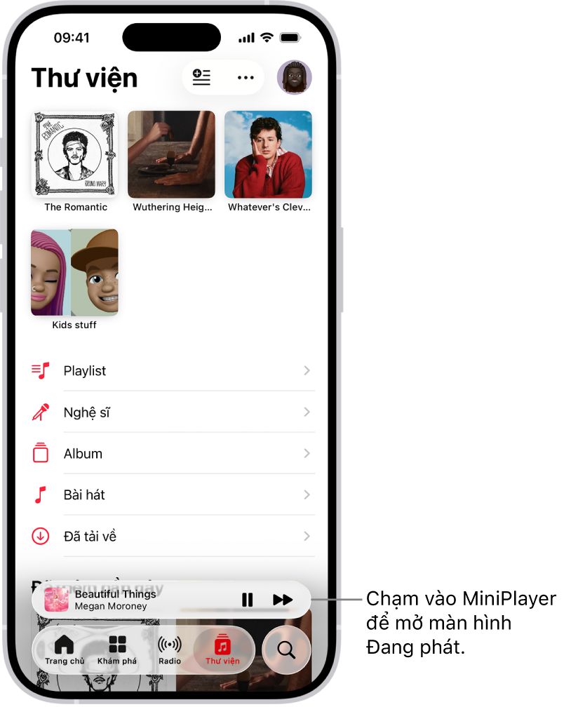 Màn hình Thư viện, đang hiển thị MiniPlayer ở gần cuối. MiniPlayer hiển thị tiêu đề của bài hát đang phát. Các nút Tạm dừng và Bài tiếp theo nằm bên phải tiêu đề bài hát. Chạm vào MiniPlayer để mở màn hình Đang phát.