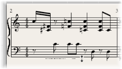 Figure. Example of drawing line below notes with Voice Separation tool.
